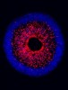 Stembook: IU Researchers Model Human Stem Cells to Identify Degeneration in Glaucoma