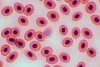 Stembook: Cord Blood as Source for Stem Cell Transplant May Outperform Accepted “Gold Standard” of Matched Sibling Donors
