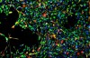 Stembook: World’s First: Drug Guides Stem Cells to Desired Location, Improving their Ability to Heal